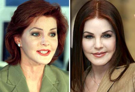 Priscilla Presley got cosmetic surgery work done on her face.