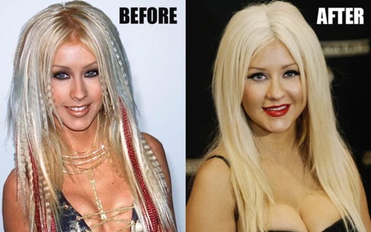 Did Christina Aguilera Get Plastic Surgery — The Answer Is Here!